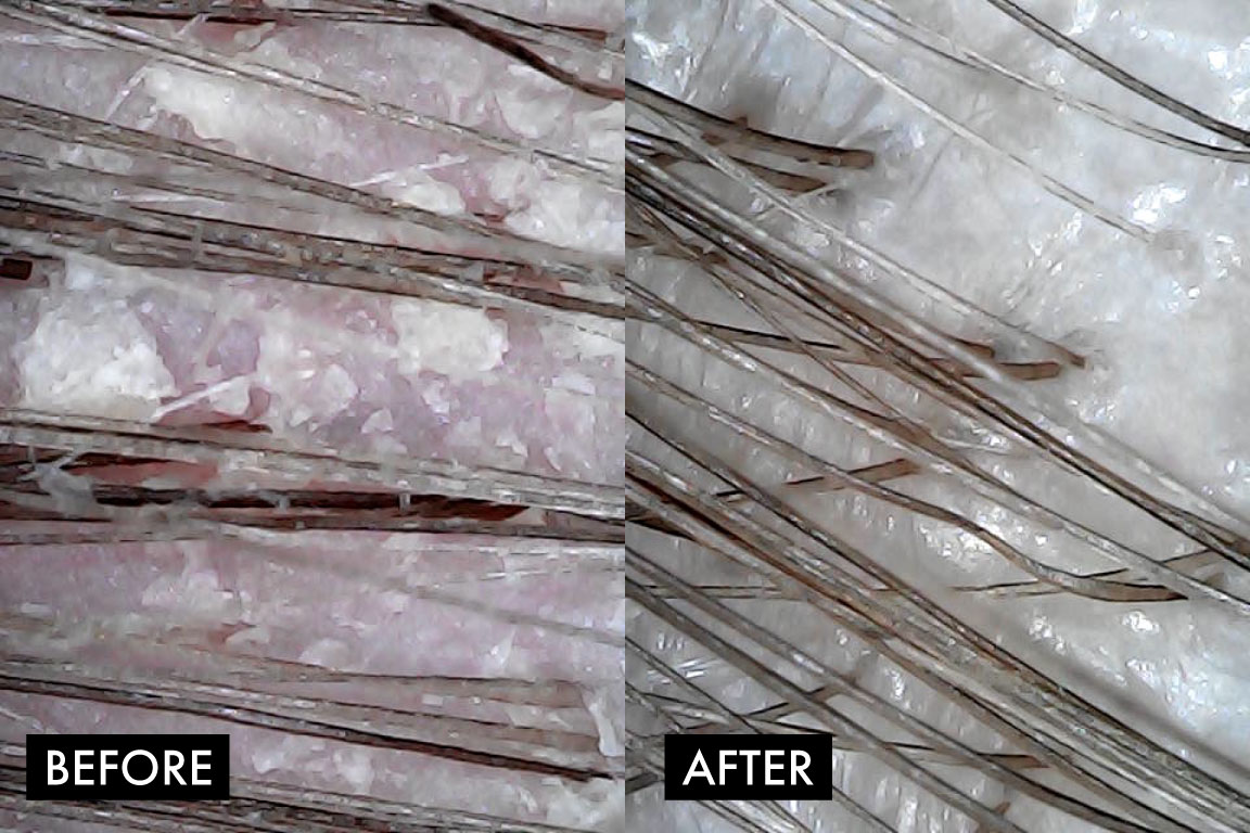 scalp_therapy_before_after_2.jpg
